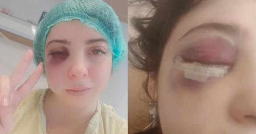 Damla yolun ortasında taciz etti: Artık yüzümün sol tarafını hissetmiyorum – son dakika Türkiye Haberleri
